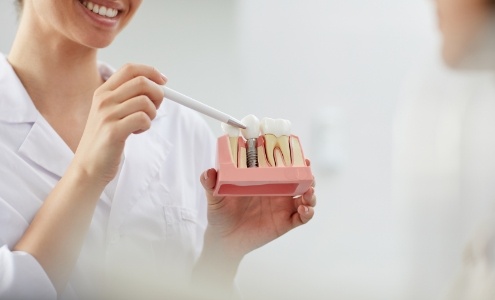Dentist pointing to model comparing dental implant to natural teeth