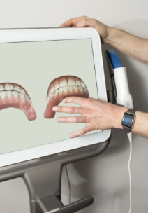 Digital images of teeth on computer screen