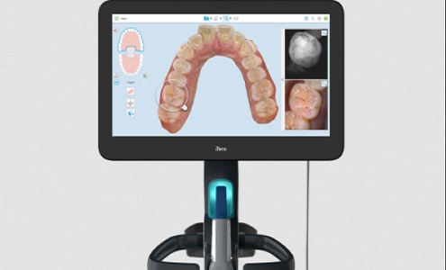 iTero digital impression system showing bite impressions