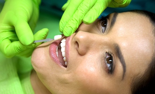 Woman at dentist getting veneers in Fort Mill