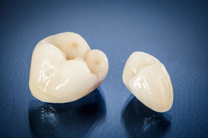 Close-up of two dental crowns on a blue surface